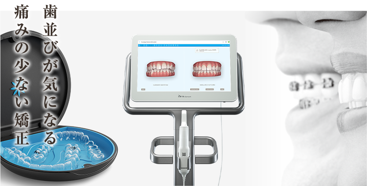 目立たない矯正治療iTeroを使用したマウスピース矯正(インビザライン)