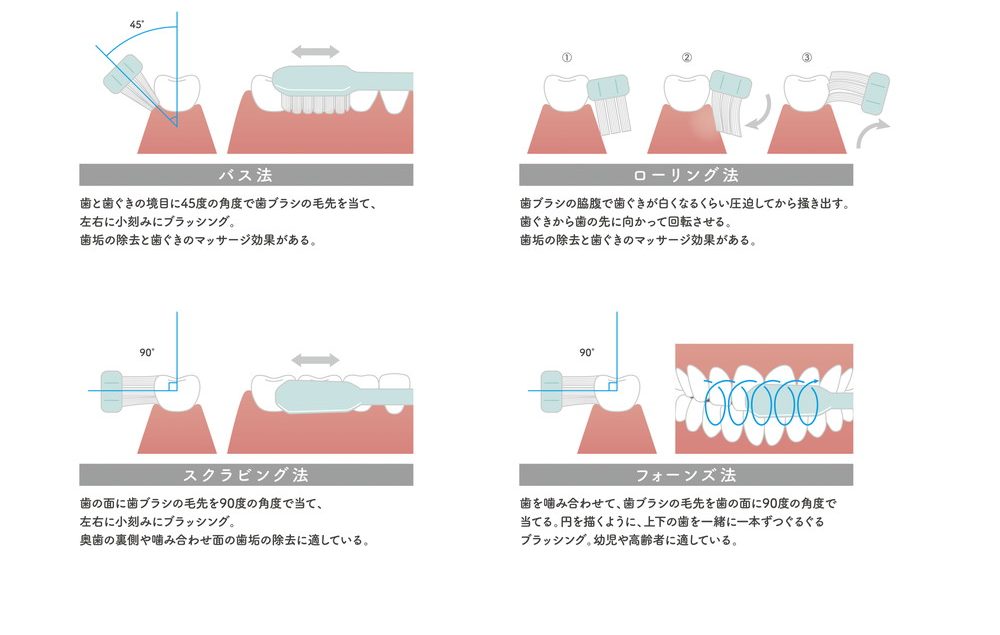 ブラッシング方法